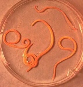 Gizonaren parasitoak Ascaride