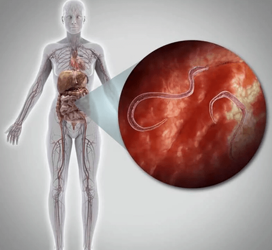 Parasitoak giza gorputzean