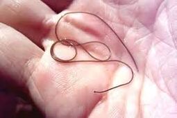 Parasitoa zure eskuko palman