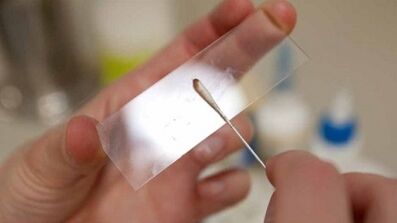 Calais analisia parasitoak identifikatzeko