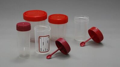 Nola prestatu parasitoen proba egiteko