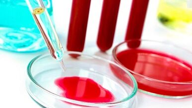 Parasitoen odol azterketa