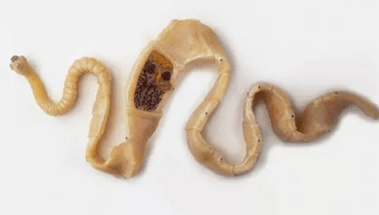 Nola deskubritu gorputzean parasitoen presentzia